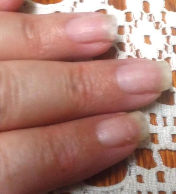 Finally - got 'em gone!